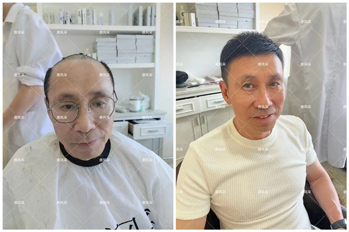 廣州哪里可以預(yù)約假發(fā)店 \