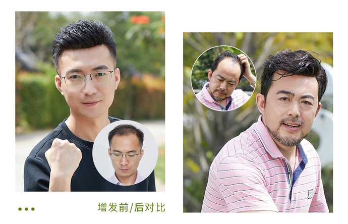 深圳男士假發(fā)多少錢 \