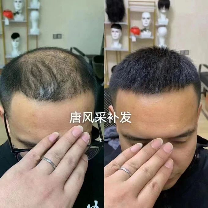 深圳男士假發(fā)多少錢 \