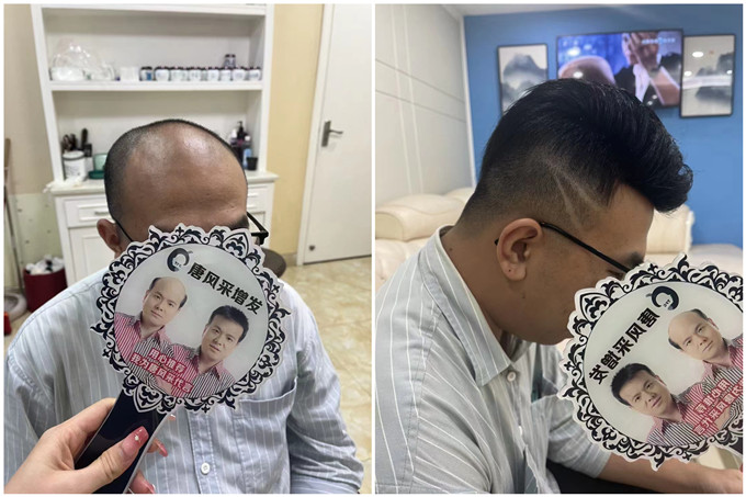 深圳男士假發(fā)多少錢 \