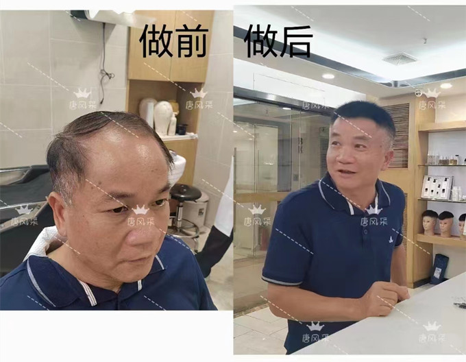 深圳男士假發(fā)多少錢 \