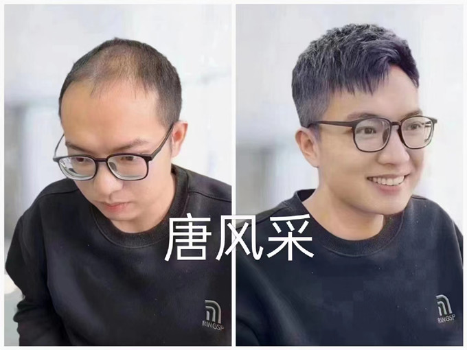 佛山男士假發(fā)店哪里有 \