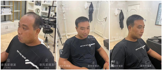 佛山男士假發(fā)店哪里有 \