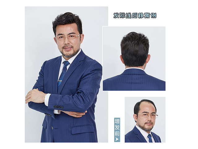 東莞什么地方有假發(fā)實(shí)體店 \