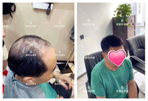 東莞什么地方有假發(fā)實(shí)體店 \