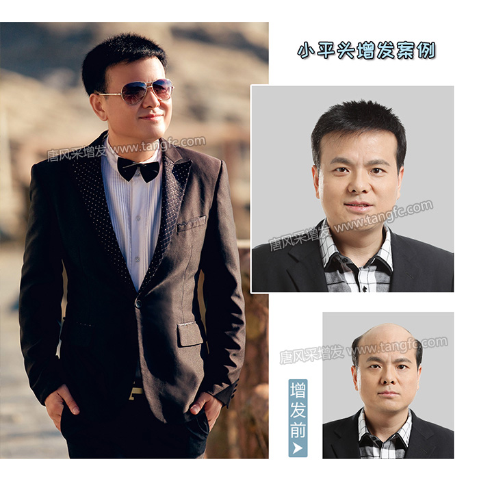 硚口區(qū)假發(fā)專賣店地址 \