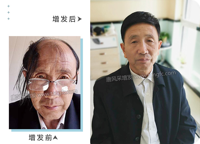 好用又實(shí)惠的嘉興假發(fā) \