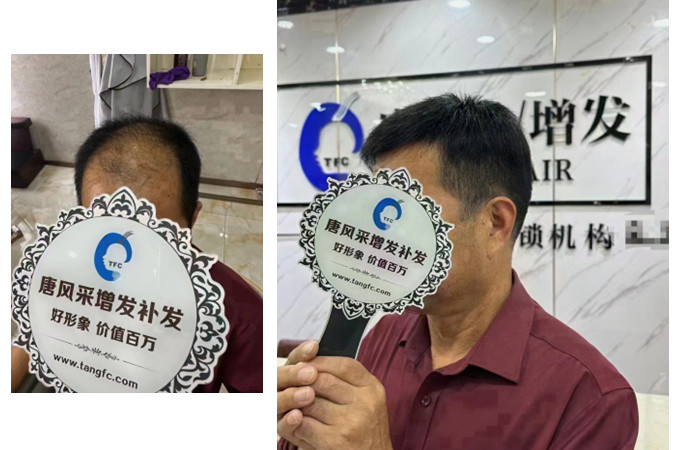 大連假發(fā)去哪里買比較好 \