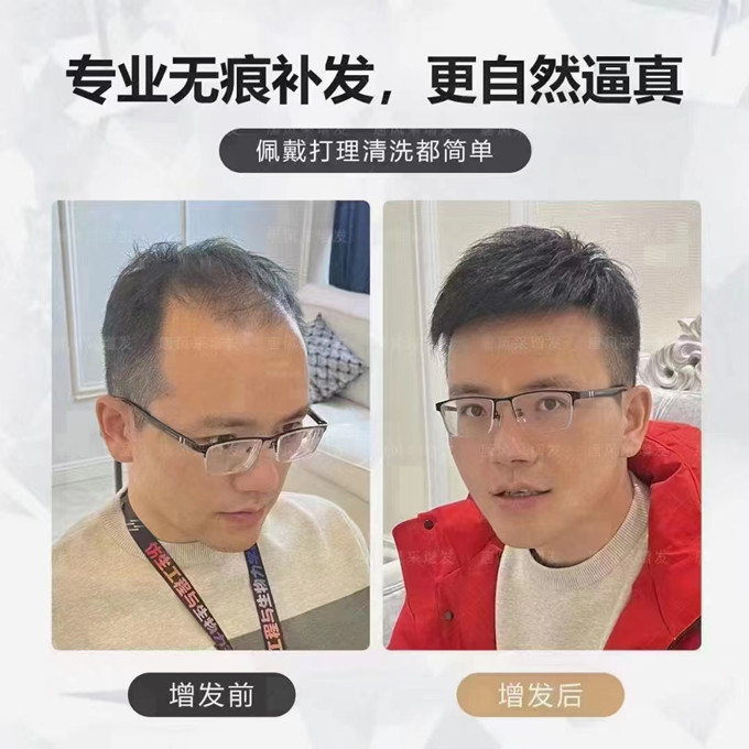 沈陽假發(fā)店哪能找到 \