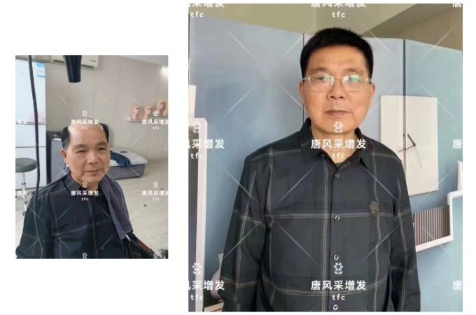 南昌哪有假發(fā)實體店 \