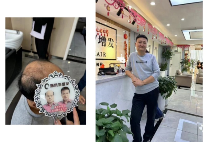 重慶有可以定假發(fā)的地方嗎 \