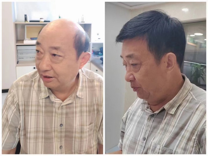 鄭州金水區(qū)假發(fā)店 \