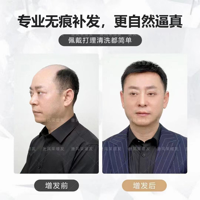 男士定制假發(fā) \