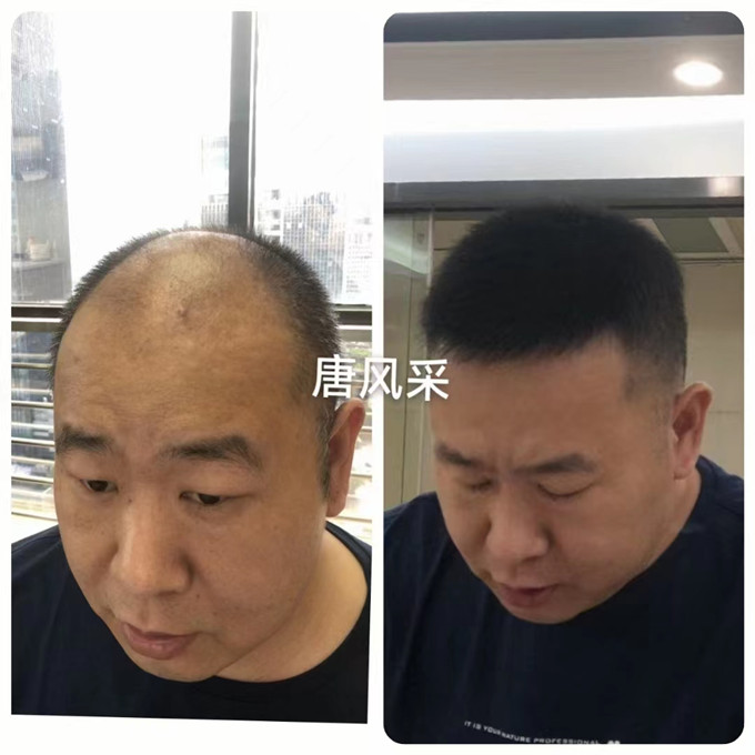 男士定制假發(fā) \