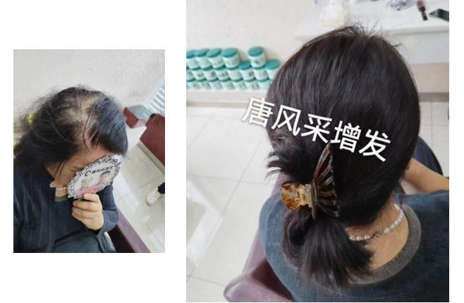 可定制假發(fā) \