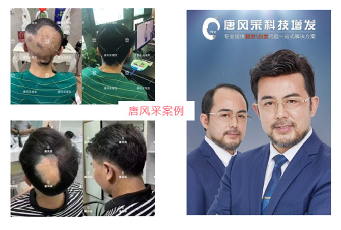 朝陽男士假發(fā)店 \