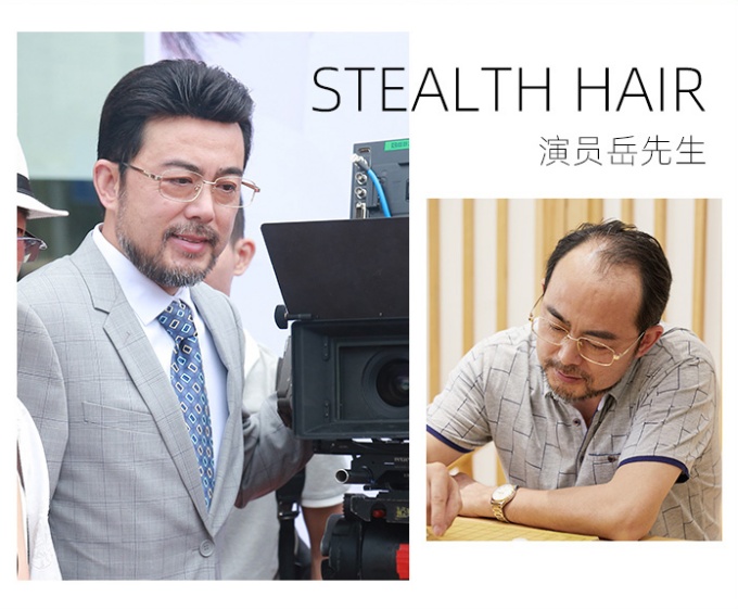 戴假發(fā)可以看出來嗎 \