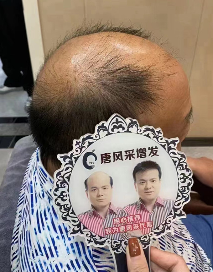 戴假發(fā)可以看出來嗎 \