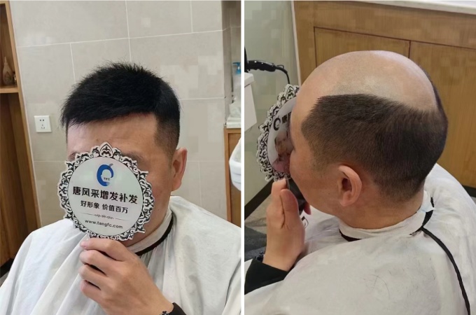 男補發(fā)假發(fā) \