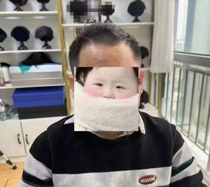 頭頂假發(fā)片 \