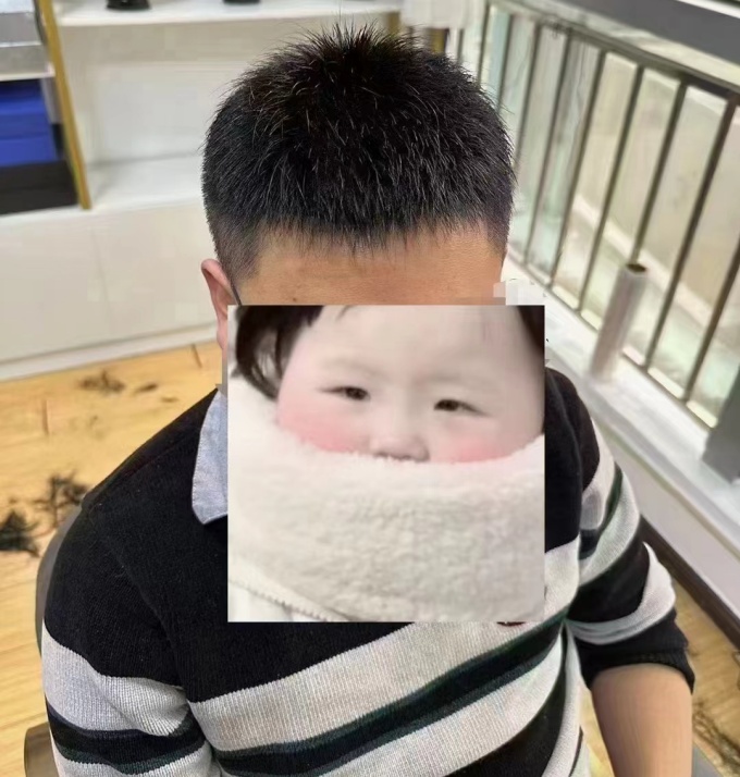 頭頂假發(fā)片 \