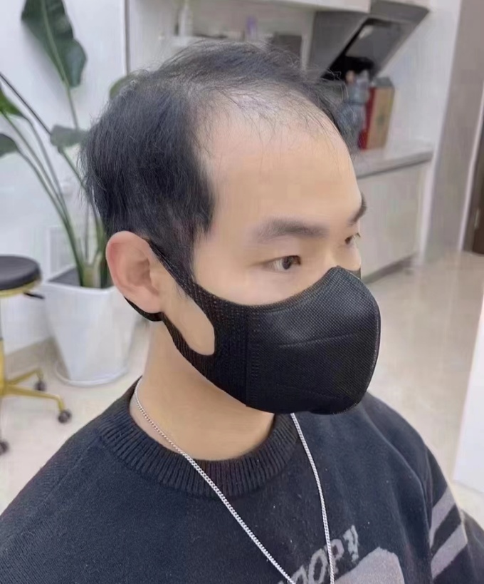 北京做定制男假發(fā) \