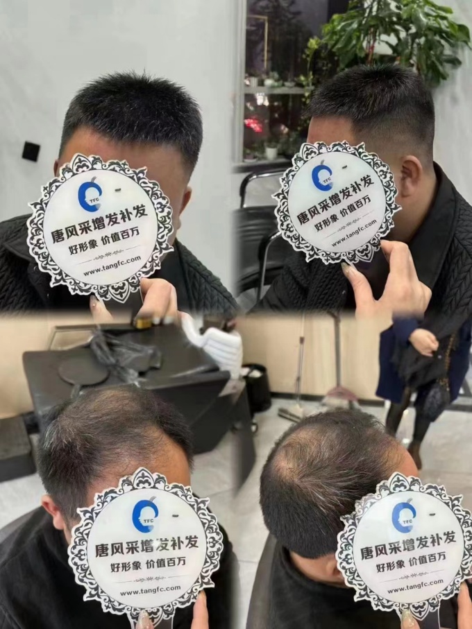 北京做定制男假發(fā) \