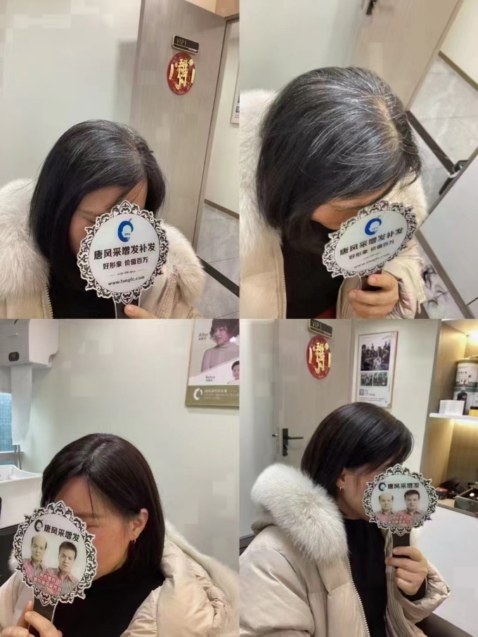 全真發(fā)定制假發(fā) \