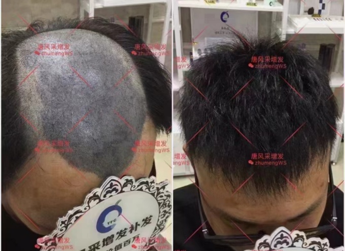 唐風(fēng)采武漢假發(fā)實體店 \