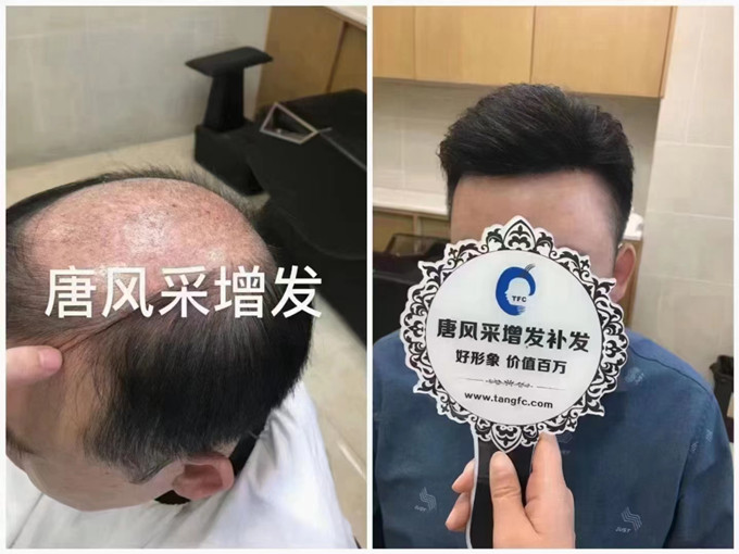 唐風(fēng)采武漢假發(fā)實體店 \