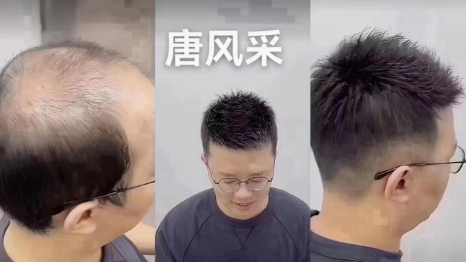 唐風(fēng)采徐州補(bǔ)發(fā)假發(fā)中心 \