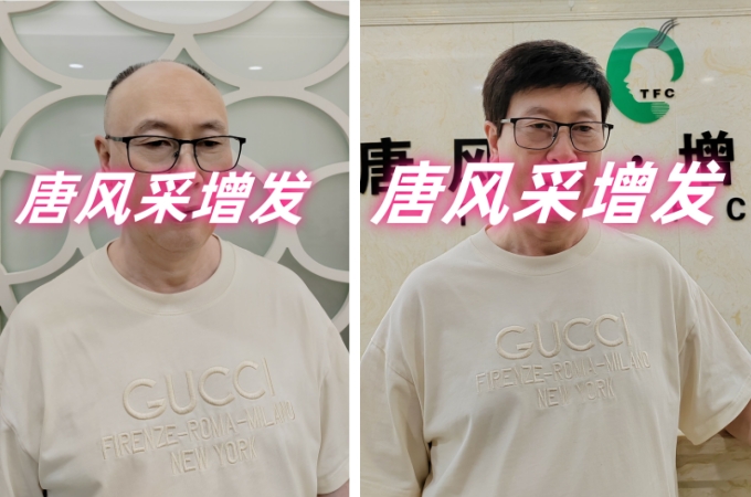 廣州定制假發(fā)店 \