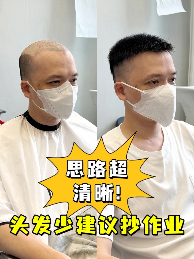 石家莊定做假發(fā) \