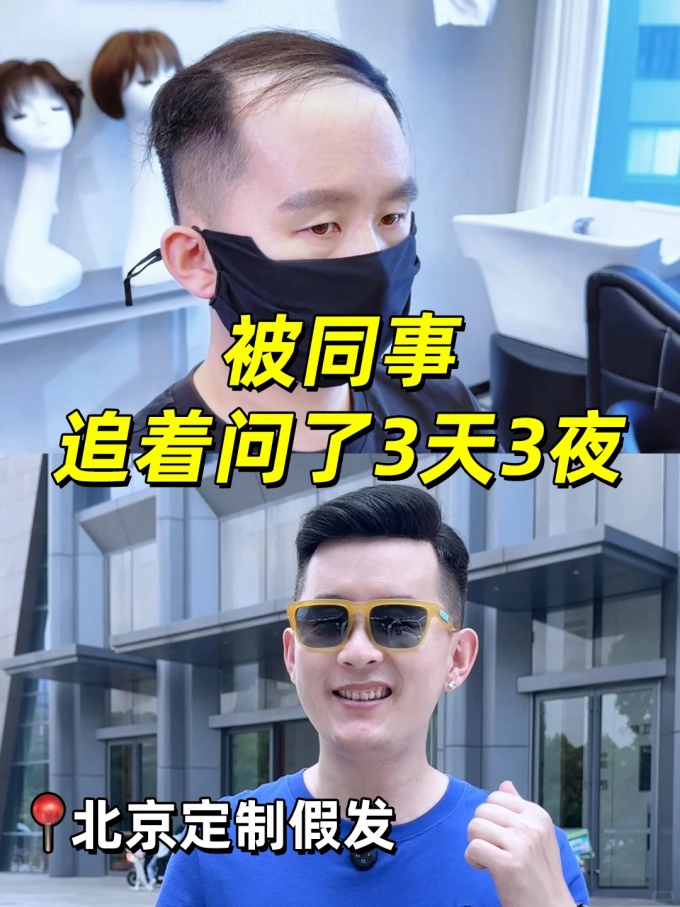 北京朝陽定制假發(fā) \