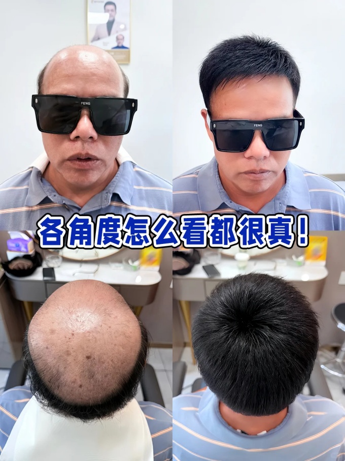 上海假發(fā)定制 \