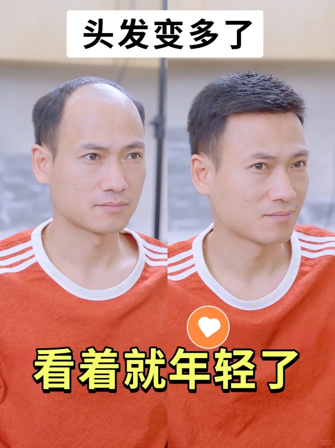 濟(jì)南定制假發(fā) \