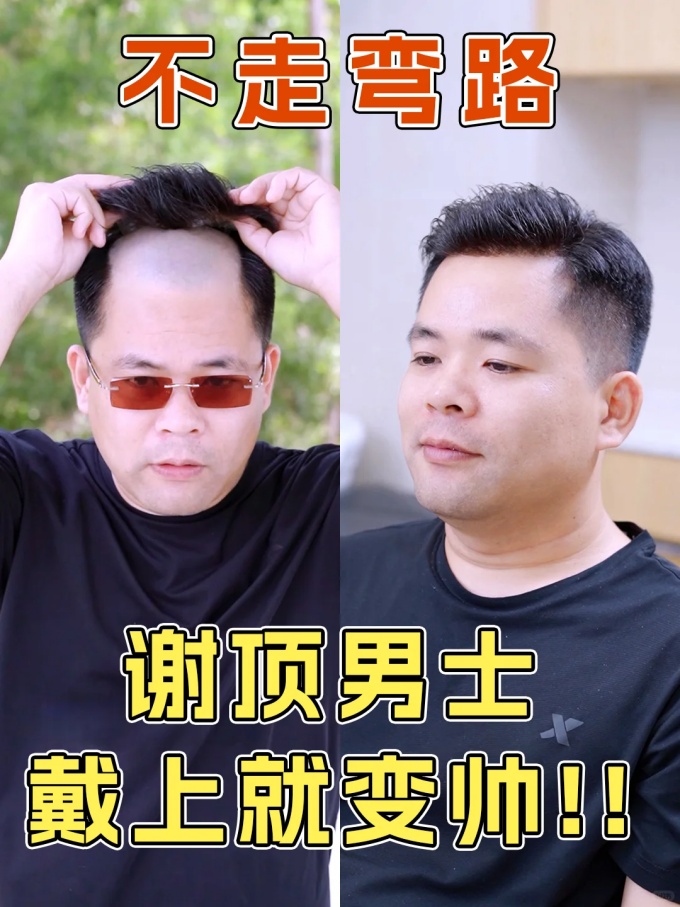 北京海淀假發(fā) \