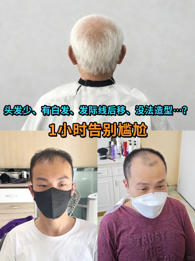 銀川定制假發(fā) \