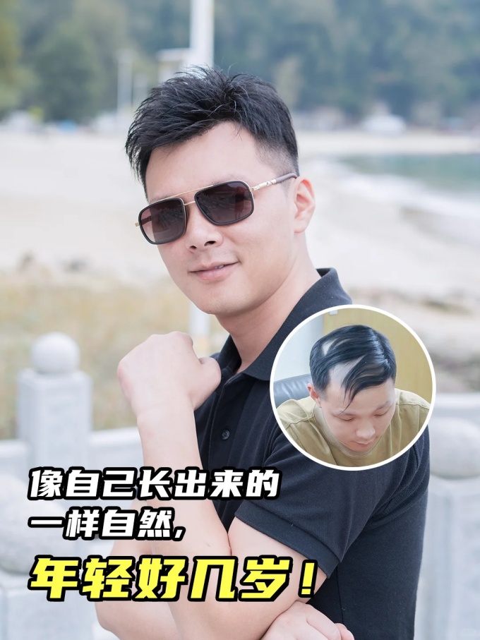 長沙假發(fā)定制 \