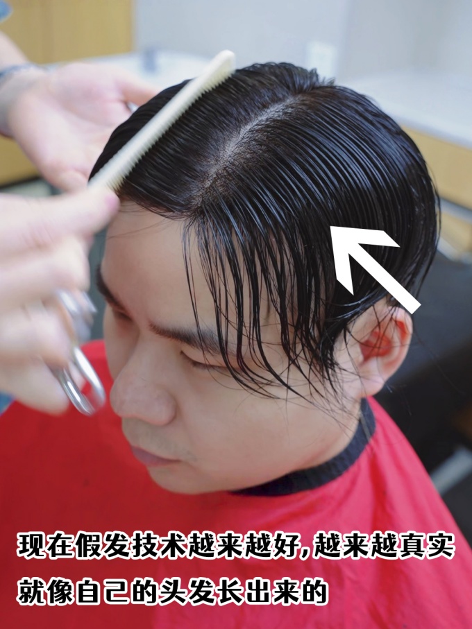 頭發(fā)稀疏怎么辦,西安補(bǔ)發(fā)假發(fā)店 \