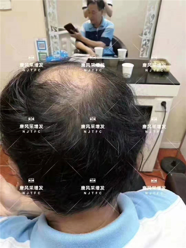 做增發(fā) “地方支援中央”政策。