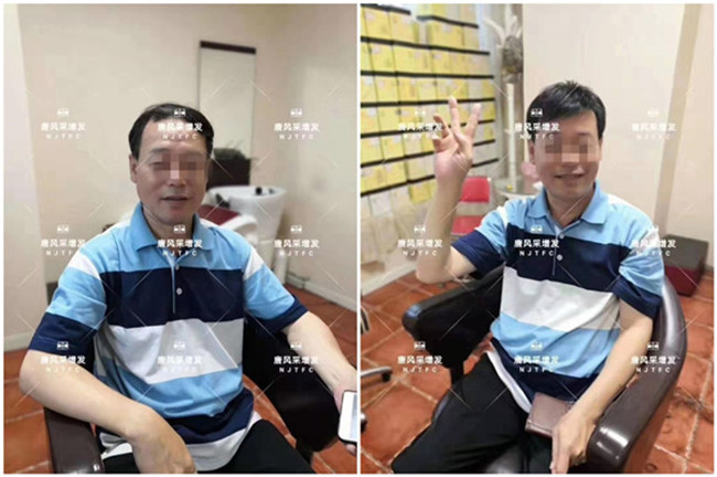 做增發(fā) 頭發(fā)變濃密了