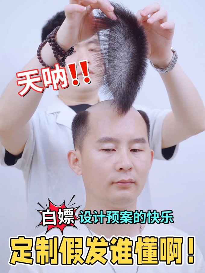 頭頂難題,假發(fā)專業(yè)定制 \