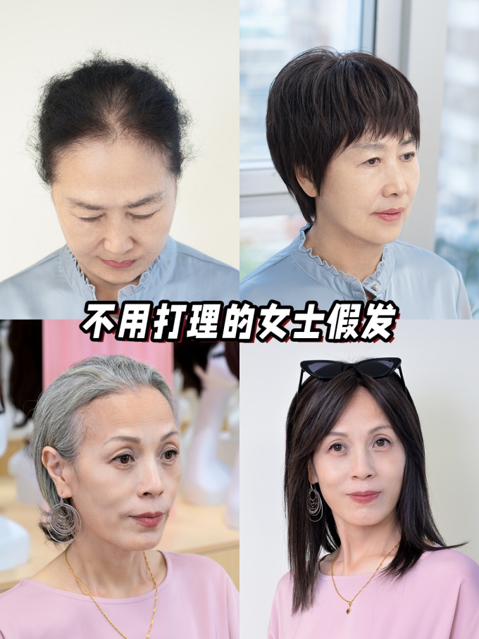 頭頂難題,假發(fā)專業(yè)定制 \