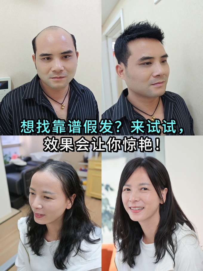 廈門假發(fā)店,靠譜的假發(fā)店 \