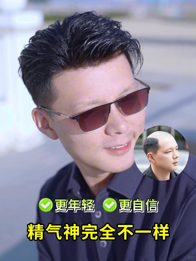 杭州選假發(fā),假發(fā)怎么選 \