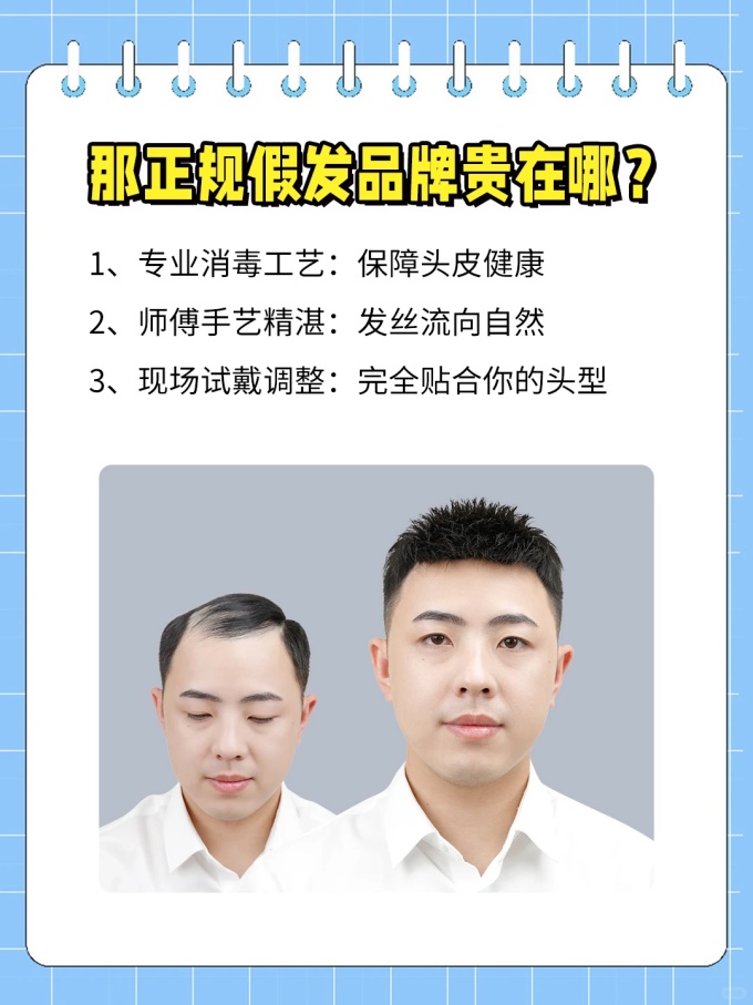 用自己頭發(fā)制作假發(fā)可以嗎 \