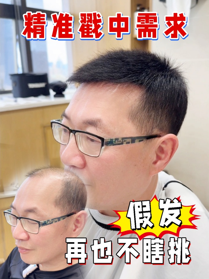 發(fā)量稀疏,訂做假發(fā) \