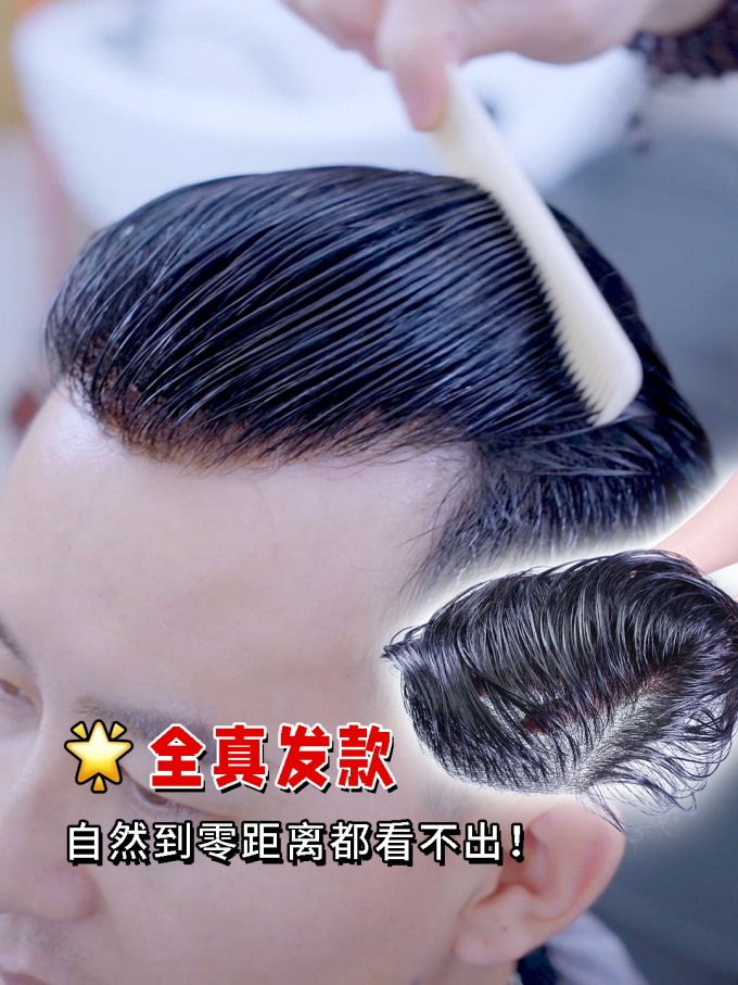 發(fā)量稀疏,訂做假發(fā) \