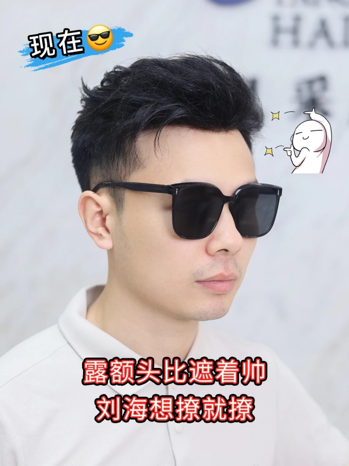 深圳假發(fā),發(fā)際線后退 \